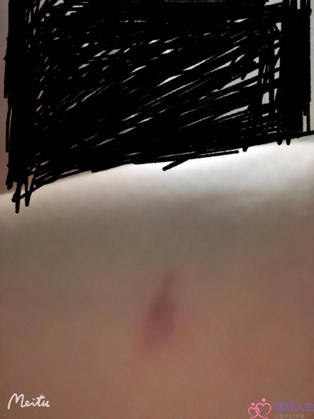 相处三年的男友为了一个已婚女人居然动手打我